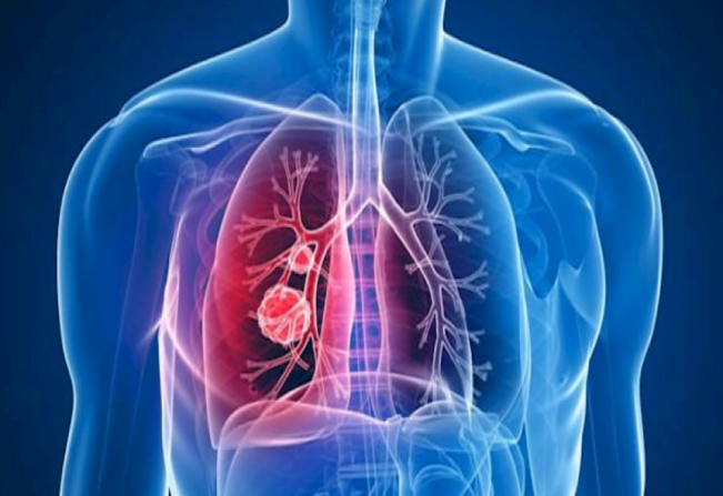 Tuberculose tem tratamento!